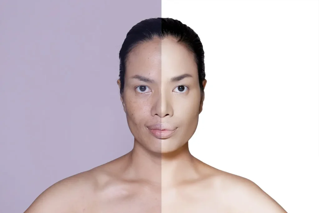 Beauté augmentée filtres